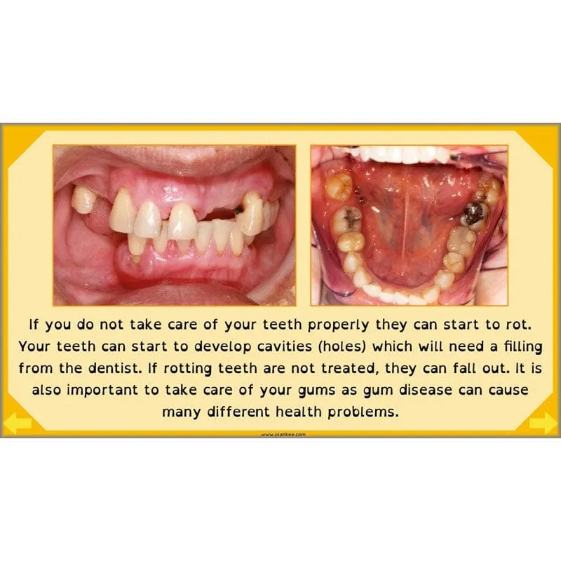 Eating and Digestion