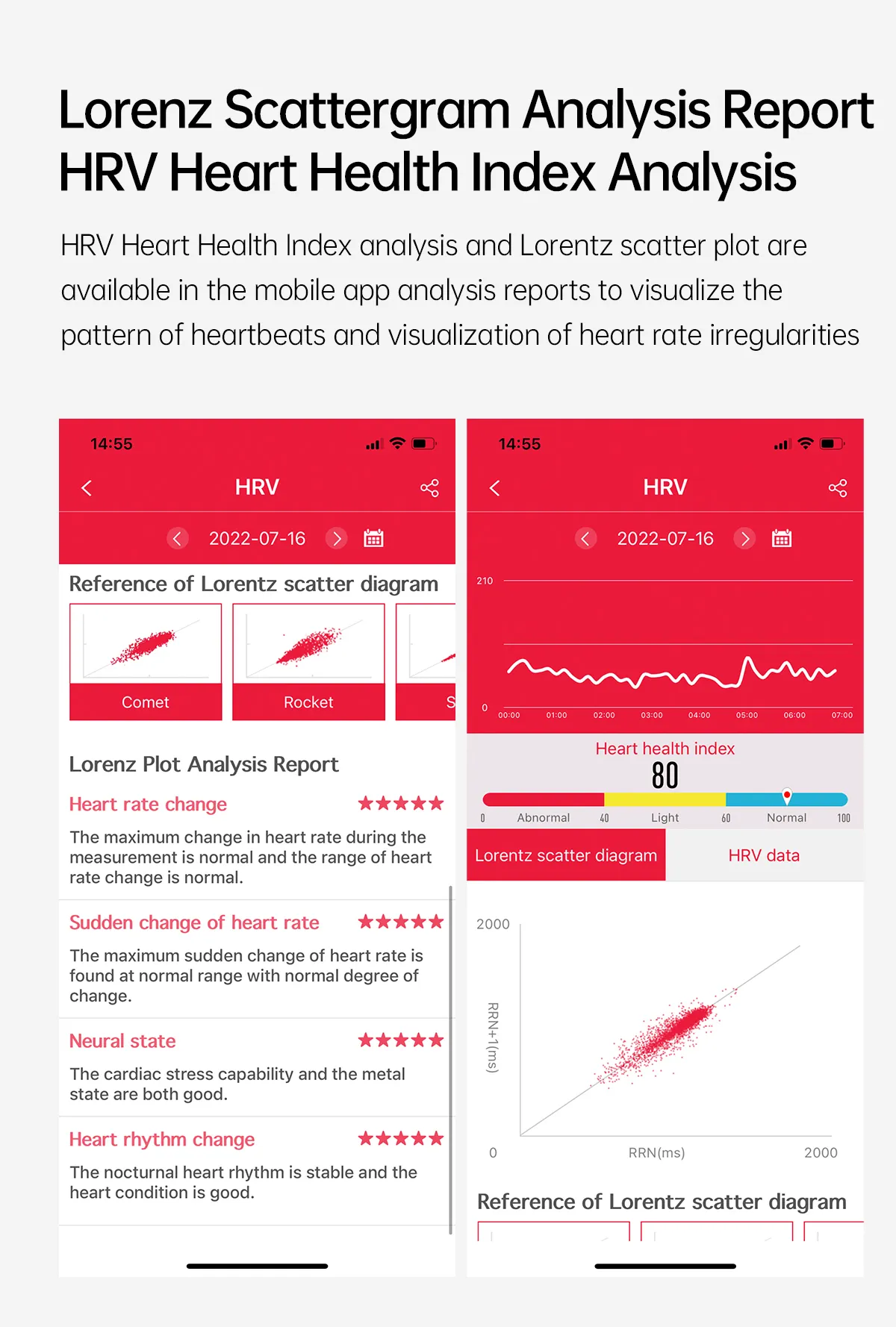 The Ultimate Health Tracker - Smart Watch with Real-time Non-invasive Monitoring of ECG PPG